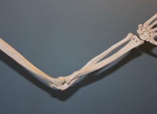 גאוט (שיגדון) ודיקור סיני