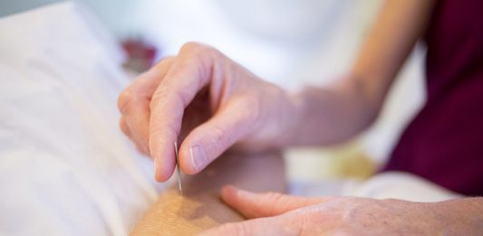 למה ללמוד קורס דיקור סיני?