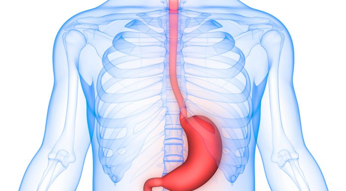 הכירו את תסמונת הוושט על שם בארט