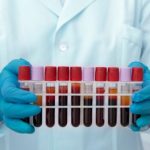 מעבדה עד הבית ועירוי נוזלים בבית: שירותים רפואיים מותאמים אישית