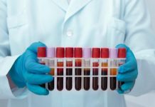 מעבדה עד הבית ועירוי נוזלים בבית: שירותים רפואיים מותאמים אישית