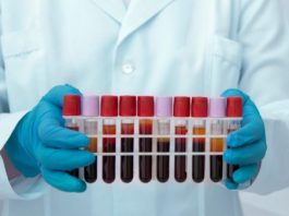 מעבדה עד הבית ועירוי נוזלים בבית: שירותים רפואיים מותאמים אישית