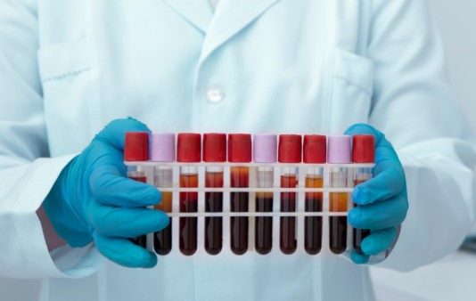 מעבדה עד הבית ועירוי נוזלים בבית: שירותים רפואיים מותאמים אישית