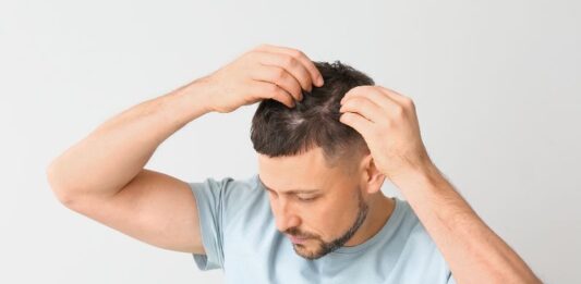 מדריך מקיף להדמיית שיער וטיפולי שיער דליל